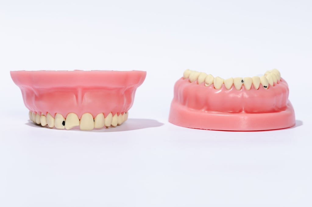 Modelo TOM basado en un caso clínico ro para entrenamiento avanzado.eal integrad