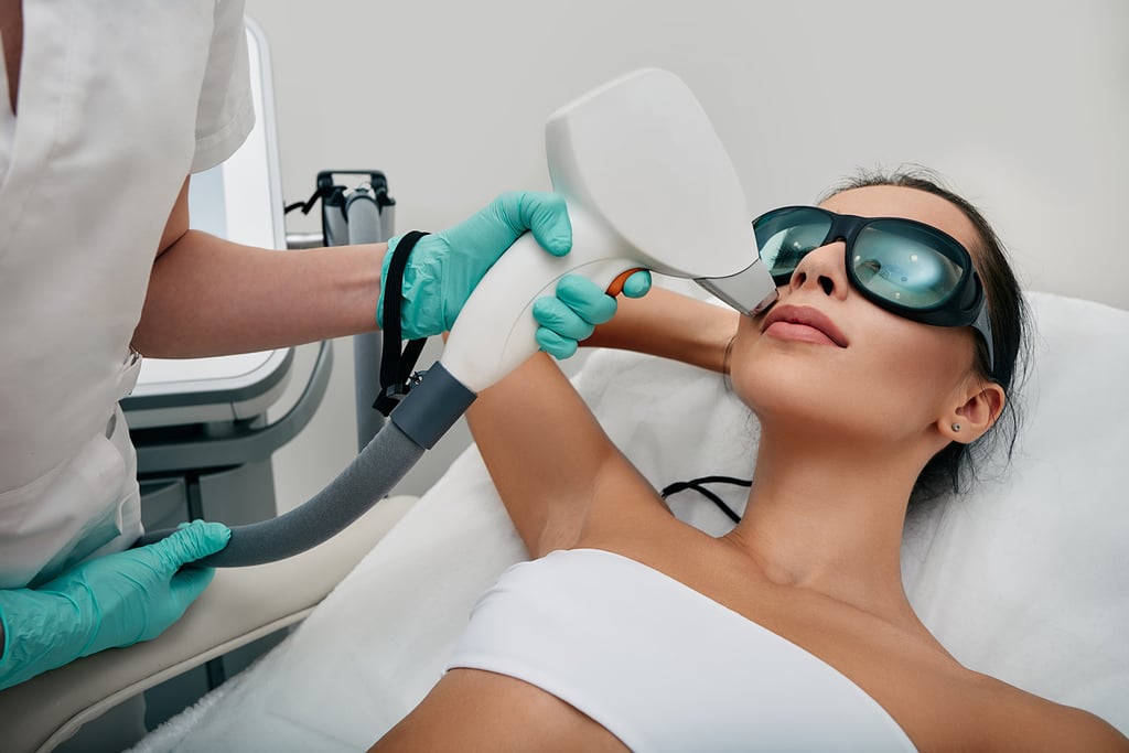 laser hair removal