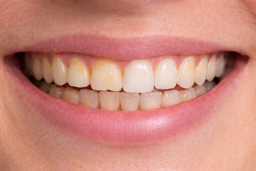 smile maleover before