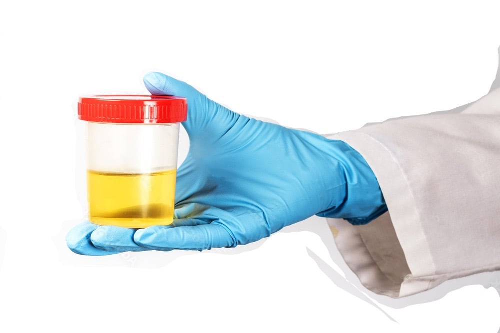 Urinary Tract Infection, Burning, Pee, Urine, Frequency, Antibiotics, Tests, Testing, UTI