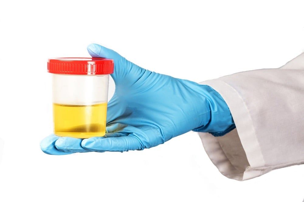 Urinary Tract Infection, Burning, Pee, Urine, Frequency, Antibiotics, Tests, Testing, UTI