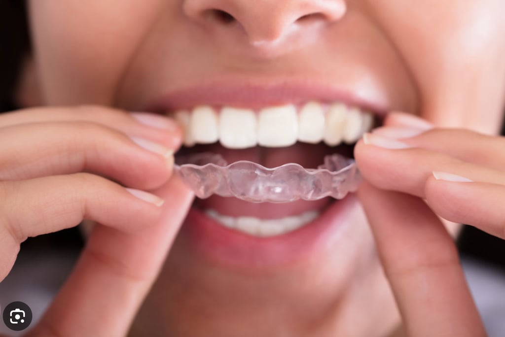 image of patient putting their invisalign in their mouth