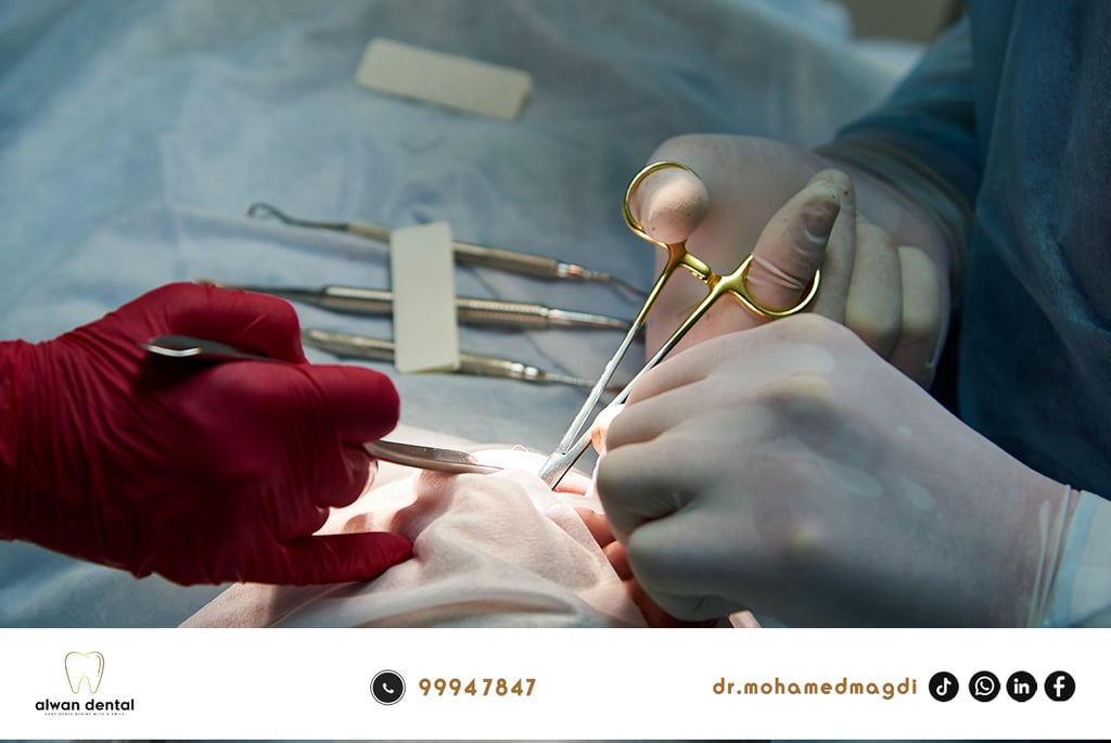 جراحة اسنان بدون الم