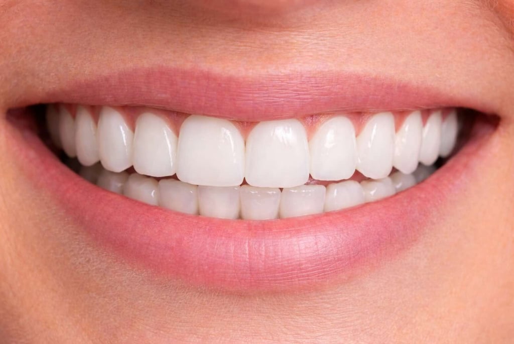 smile makeover after