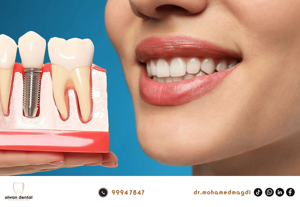 ابتسامه نظيف