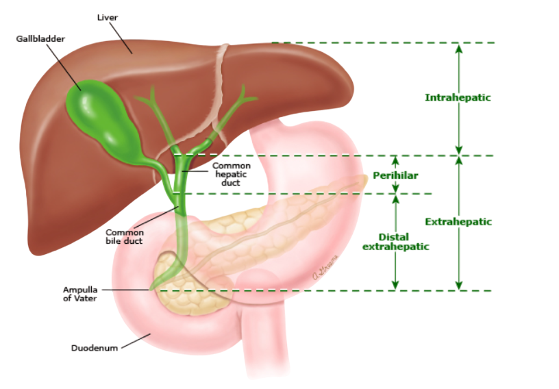Esquema da via biliar e fígado para diferenciar os tipos de tumores