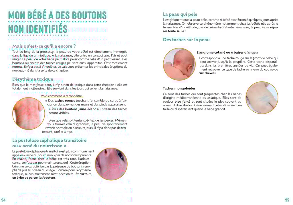 Exemple de chapitre du livre. Reconnaitre les boutons chez mon bébé