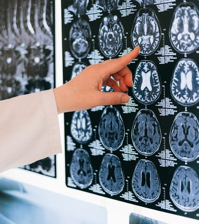 cerebro exitoso