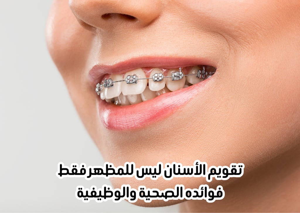 dental-braces-health-benefits