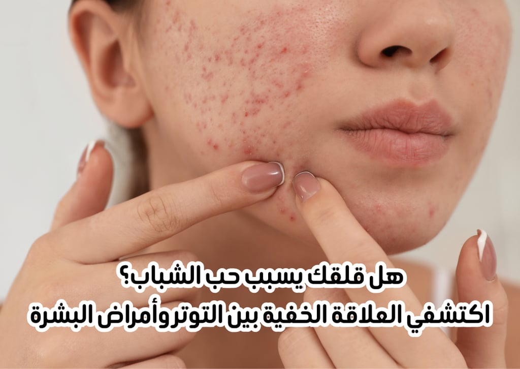 stress-and-skin-diseases