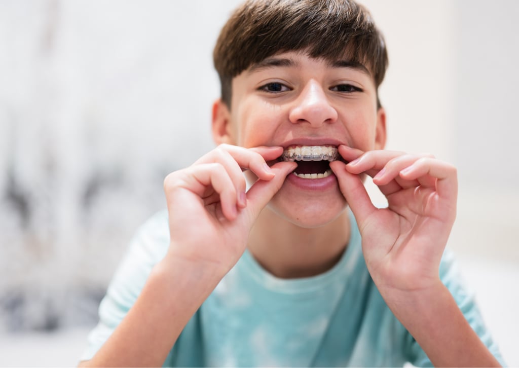 dental-braces-health-for kids