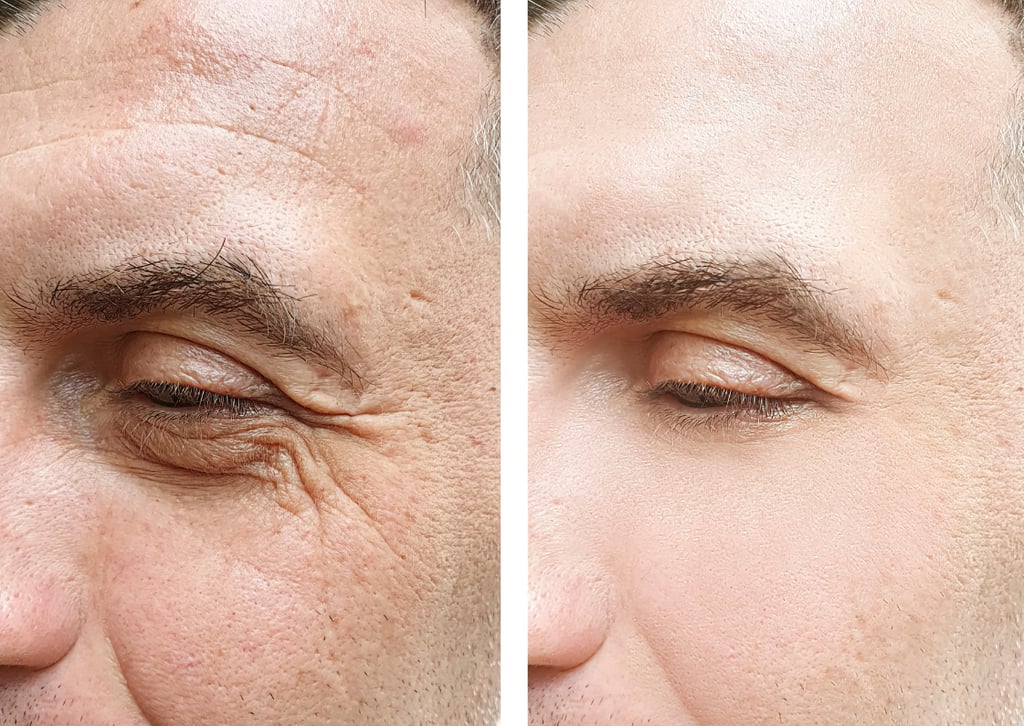 natural-anti-aging-solutions