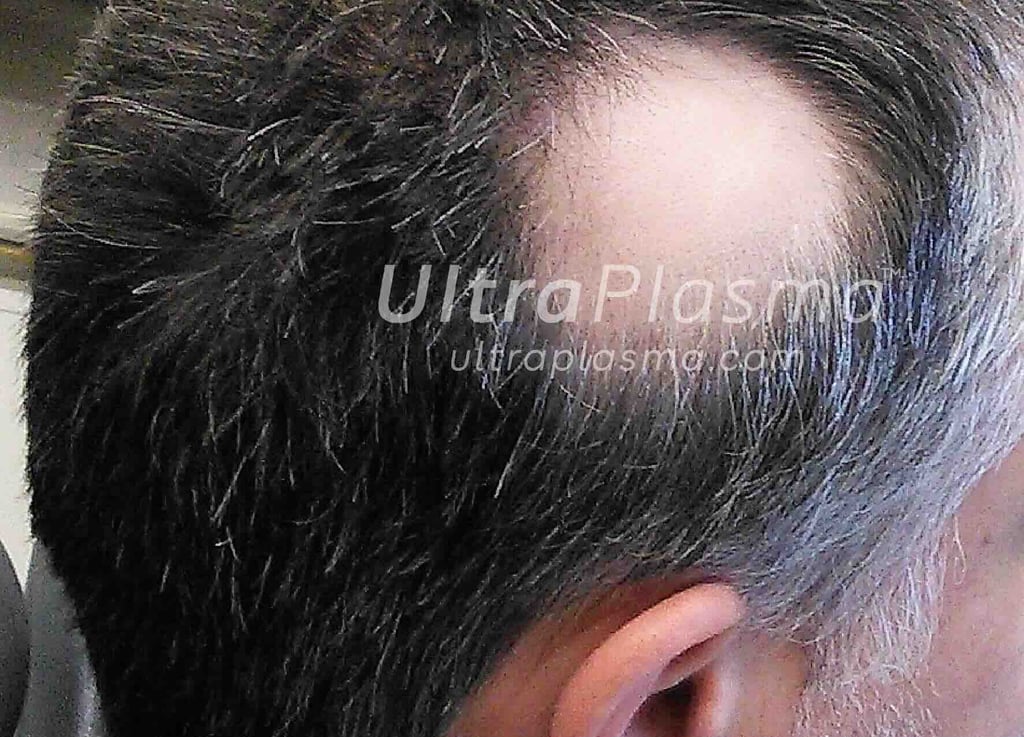 _ultra_plasma_ultra_plazma_ultra-plasma_ultra-plazma