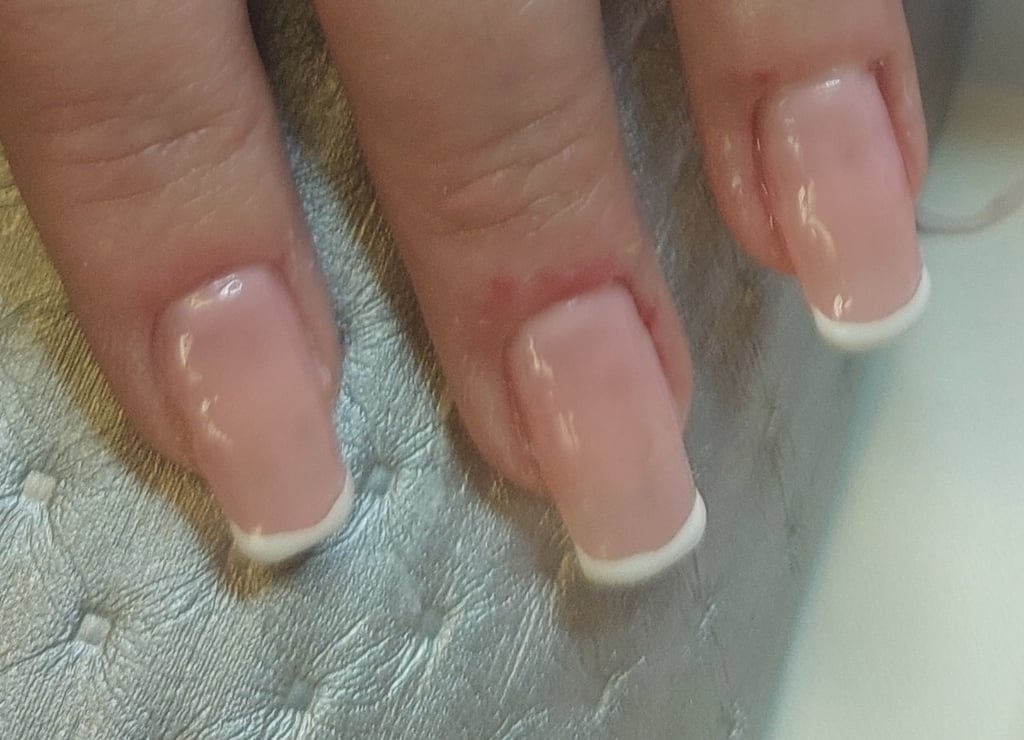 Behandling med tippar & Fransk