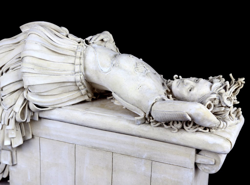 Small ceramic sculpture of a woman in a fancy skirt on exam table with bandages and a drain for breast reconstruction.