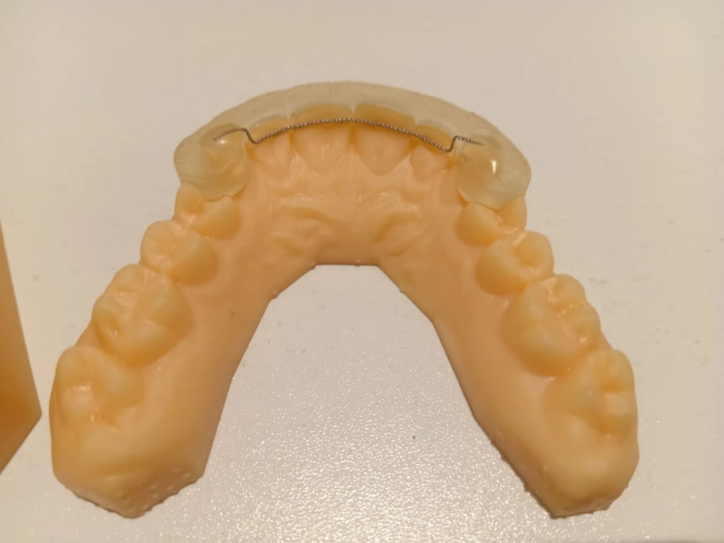 Fixed Bonded Retainer with 3D printed fitting jig