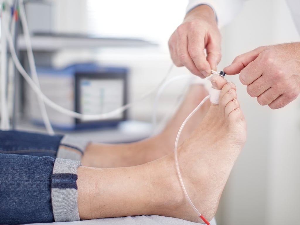 vascular ultrasound photoplethysmography ppg finger toe pressure index digital diabetes blood flow peripheral artery disease
