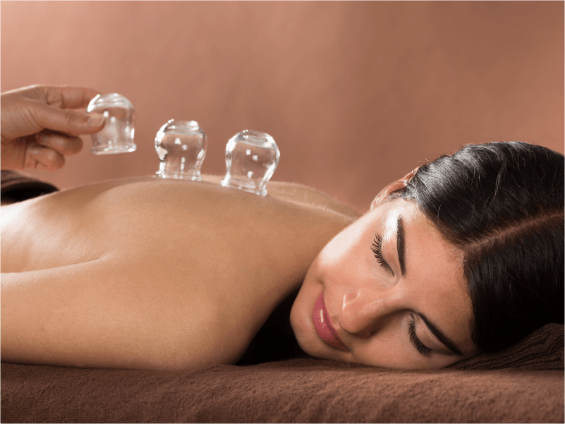 Professionele cupping sessie bij Medisch Pedicure Grote Berg in Callantsoog.