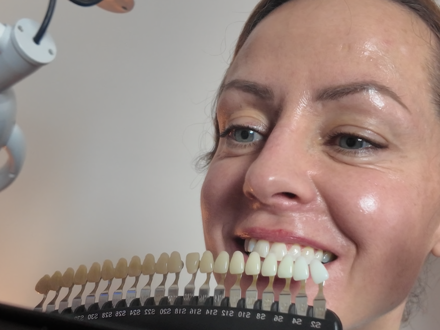 GloSmilz teeth whitening analysis