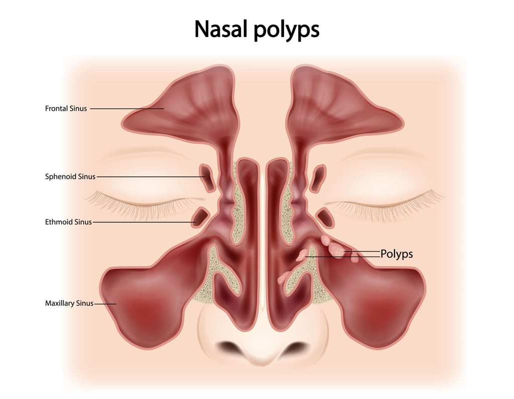 sinus cavities