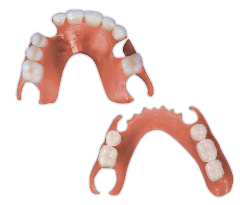 Protesis-Removible-Flexible-PartialFlex