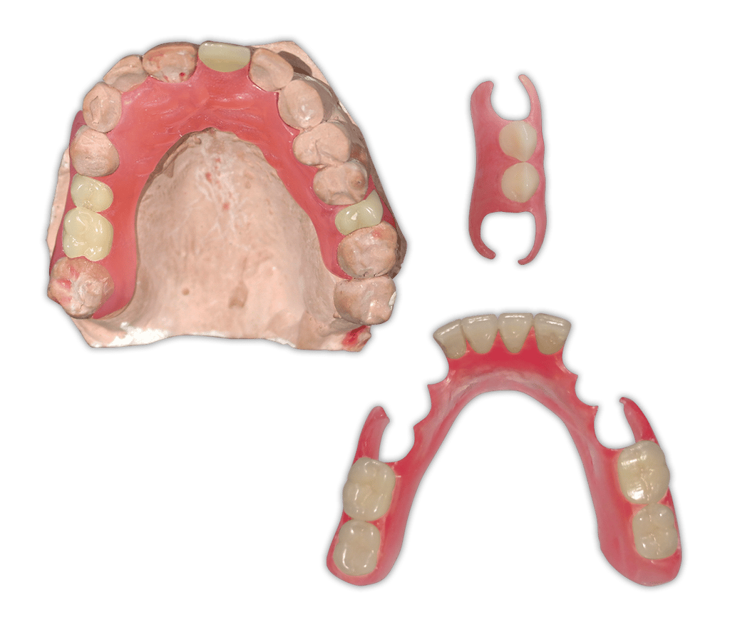 Protesis-Removible-Flexible-Valplast