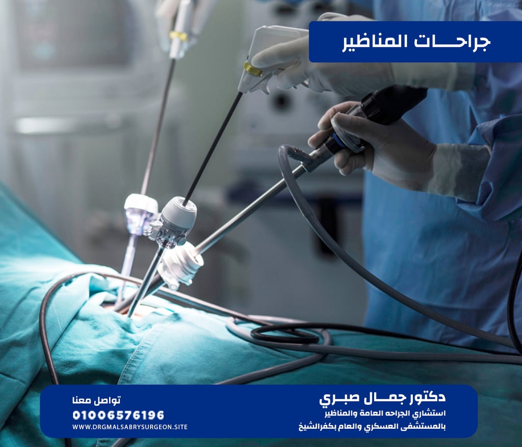 جراح مناظير في كفرالشيخ