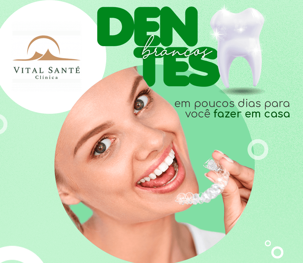 Clareamento caseiro