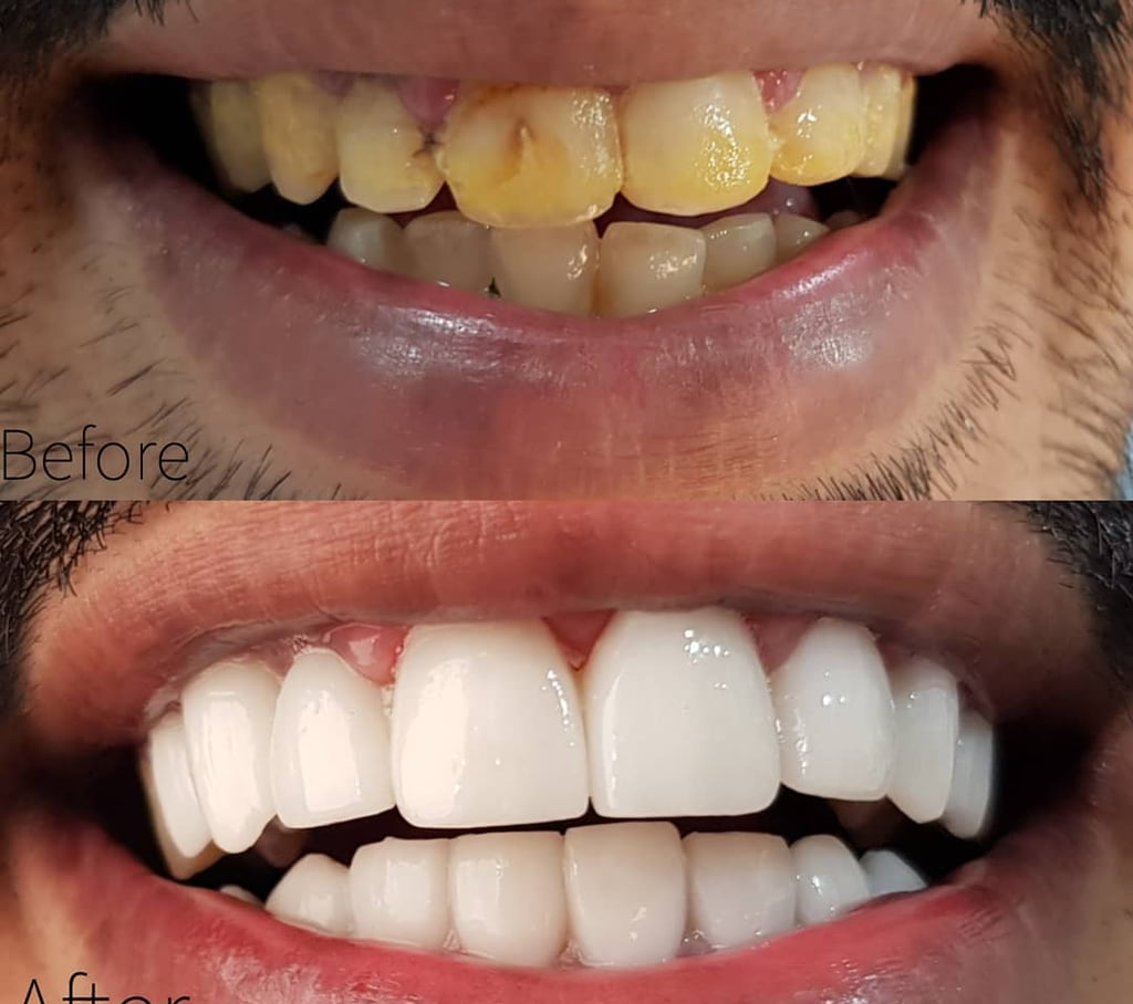 دكتور اسنان في الكويت