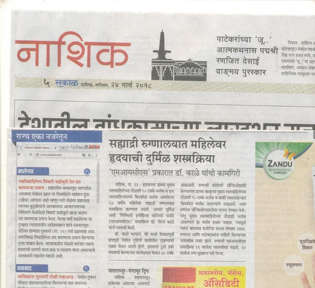 press release