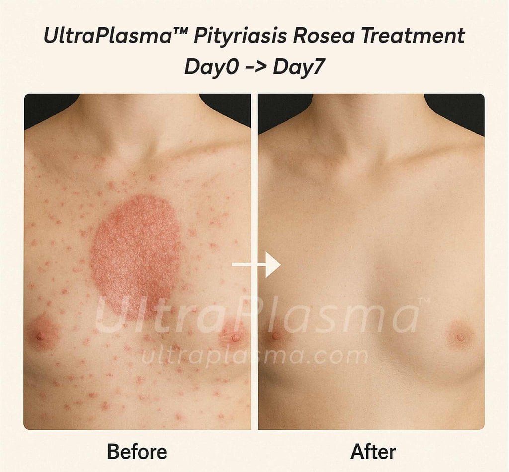 ultra_plasma_ultra_plazma_ultra-plasma_ultra-plazma