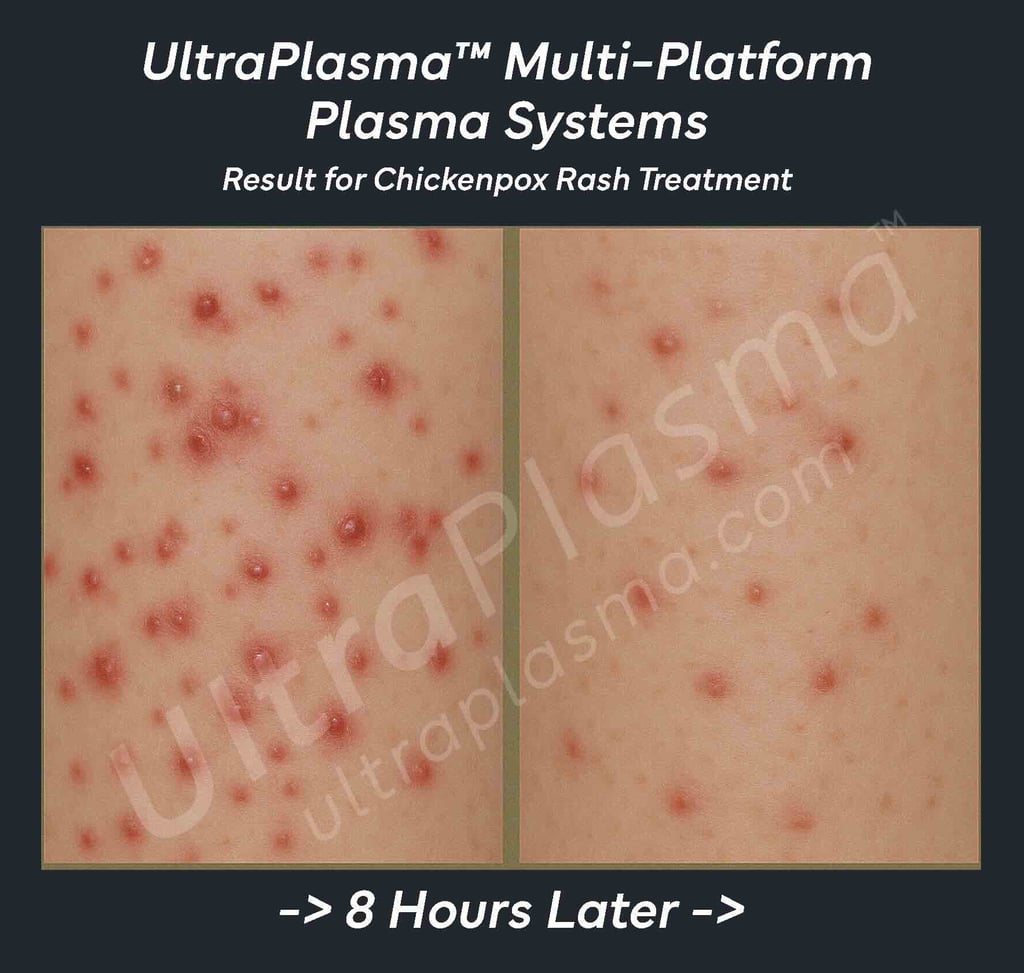 ultra_plasma_ultra_plazma_ultra-plasma_ultra-plazma