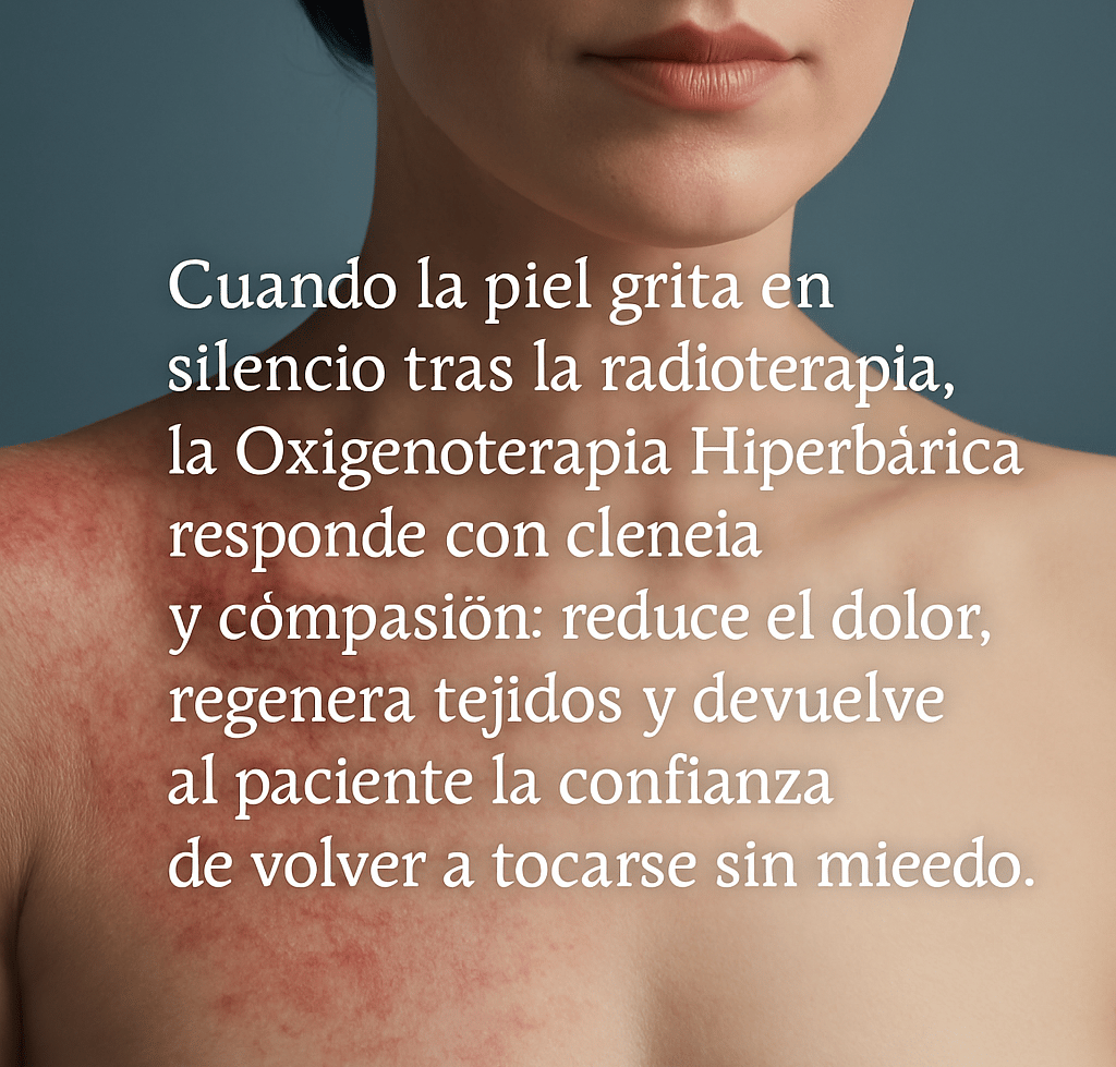 Cuando la piel grita en silencio tras la radioterapia, la OTHB responde 