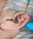 Réflexologie Auriculaire