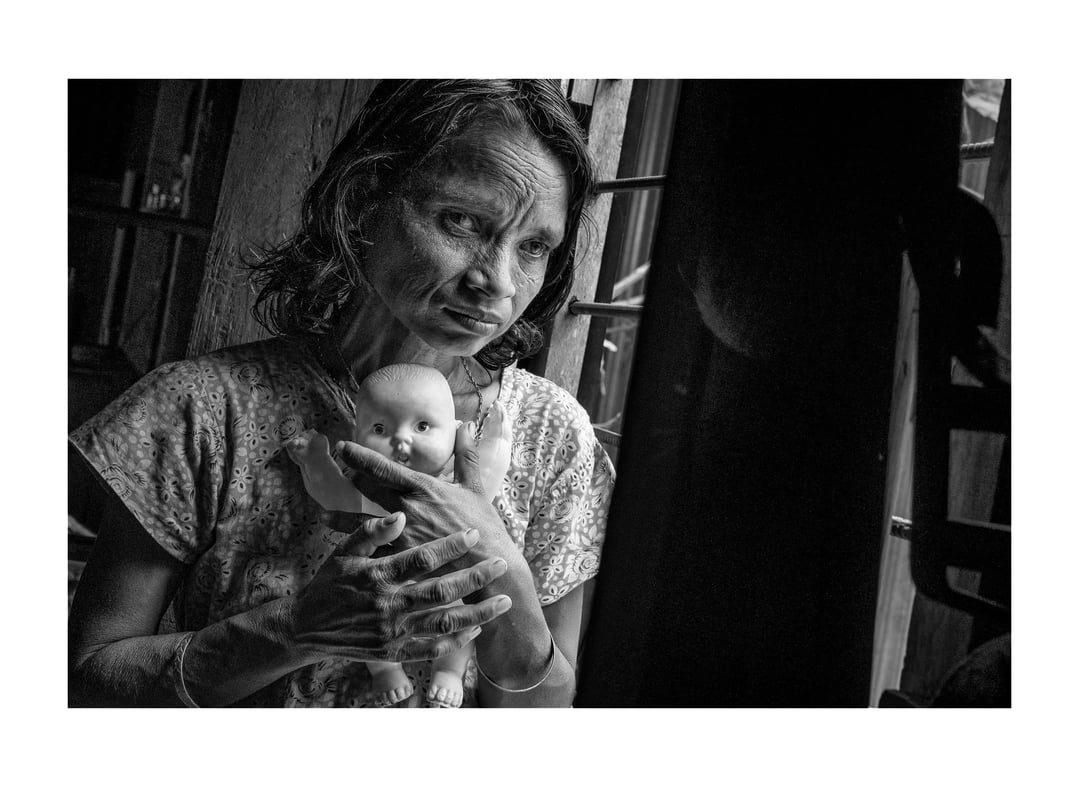 Sujan Sarkar Physically Challenged Story 89
