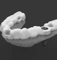 Dental Implant Surgical guide / Template
