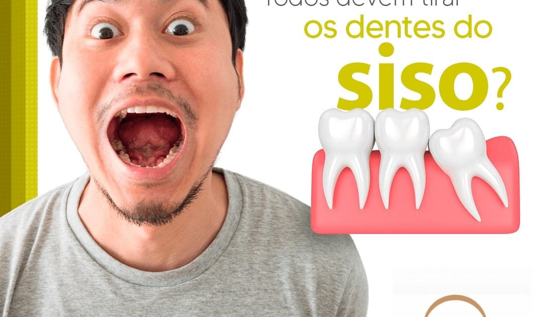 Todos devem tirar o Dente do Siso? | Dentista Recreio