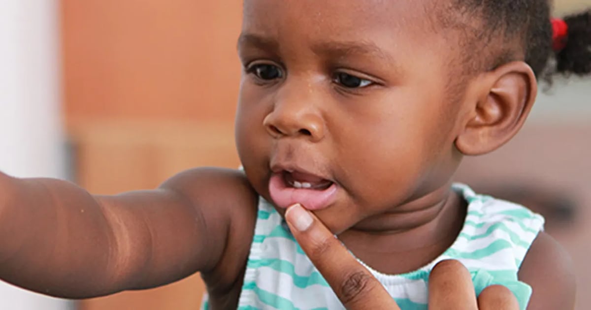 Turbine Dentaire Pédiatrique Haute Vitesse LED - Fibre Optique, Compatible 2/4 Trous