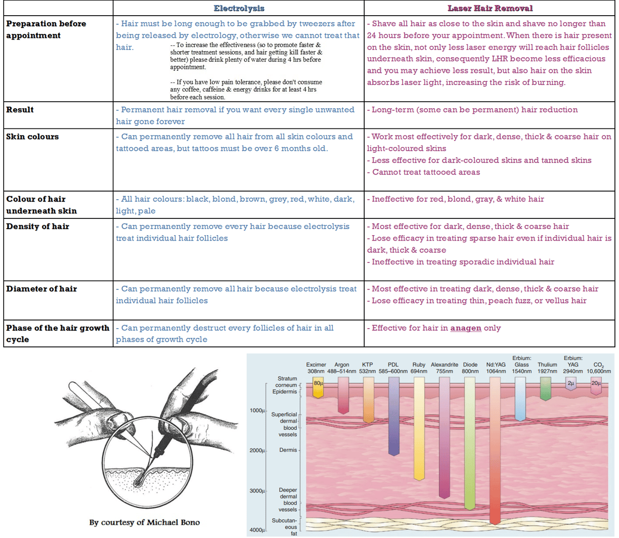 electrolysis-vs-laser