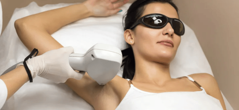 A woman wearing protective sunglasses is getting a laser for under arm hairs.