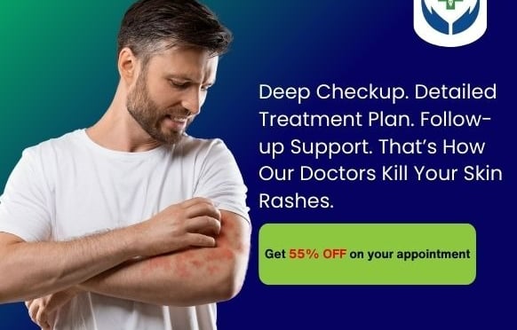 Our doctors will provide you with detailed plans to remove your skin rashes easily.