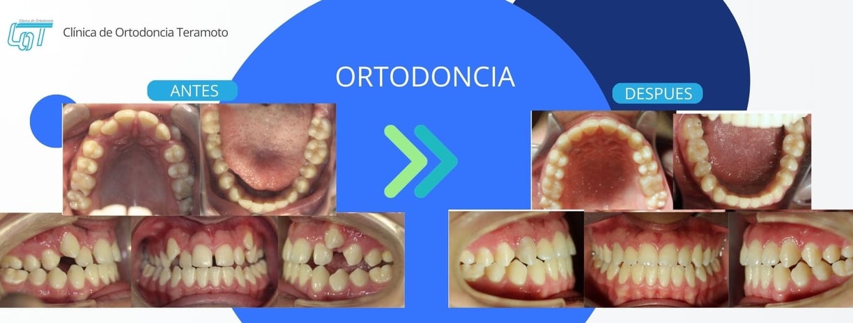 tratamiento de ortodoncia