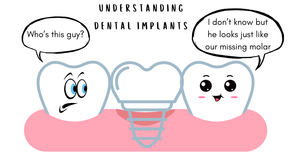 Dental Implants