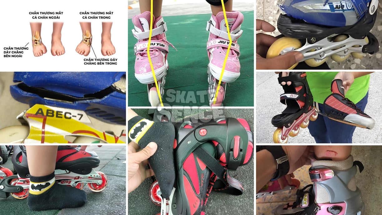 Lựa chọn đôi giày patin chất lượng và đảm bảo an toàn sức khỏe là rất quan trọng.