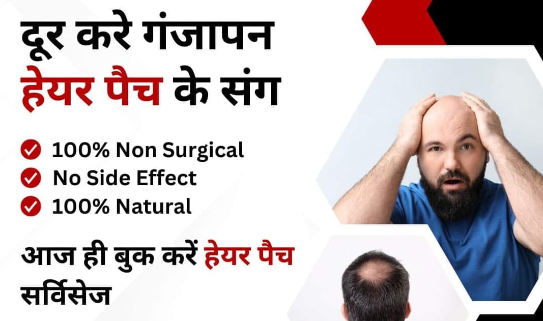 hair replacement centre
