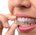 ortodoncia invisible con alineadores dentales