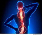 Neck Pain, Back Pain