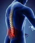 Low back pain