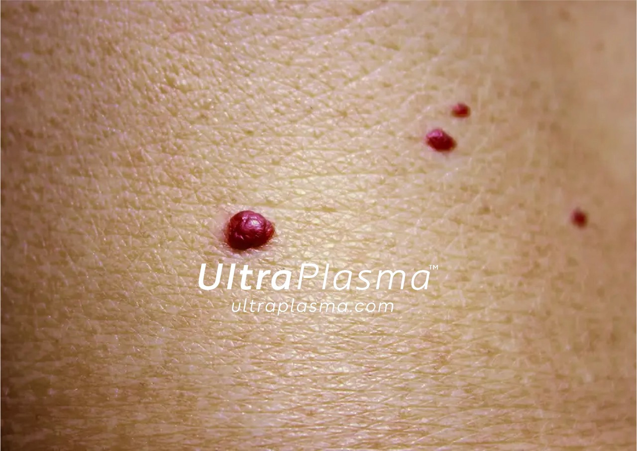 _ultra_plasma_ultra_plazma_ultra-plasma_ultra-plazma