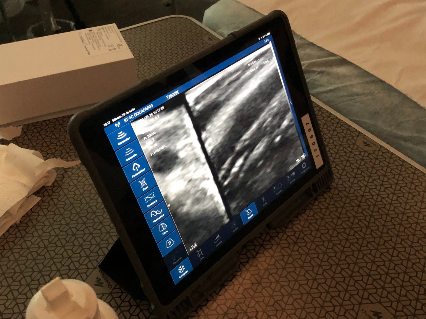 Taller para aprender el manejo de una sonda lineal biplano